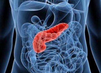 Cos'è il pancreas e quali sono le sue funzioni?