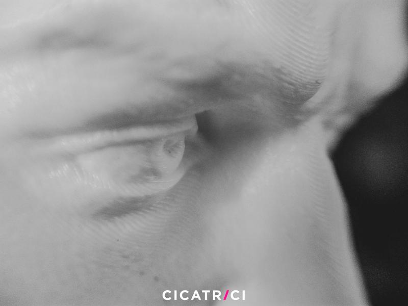 Cicatrici3