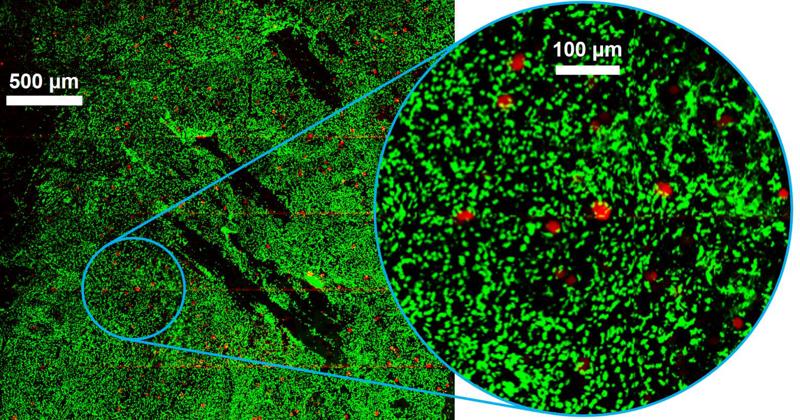 Immagine realizzata con l’innovativo microscopio realizzato nei laboratori del Politecnico di Milano, in grado di visualizzare simultaneamente la fluorescenza di specifiche cellule (in verde) e la vibrazione molecolare dei lipidi (in rosso) in un tessuto biologico Immagine realizzata con l’innovativo microscopio realizzato nei laboratori del Politecnico di Milano, in grado di visualizzare simultaneamente la fluorescenza di specifiche cellule (in verde) e la vibrazione molecolare dei lipidi (in rosso) in un tessuto biologico