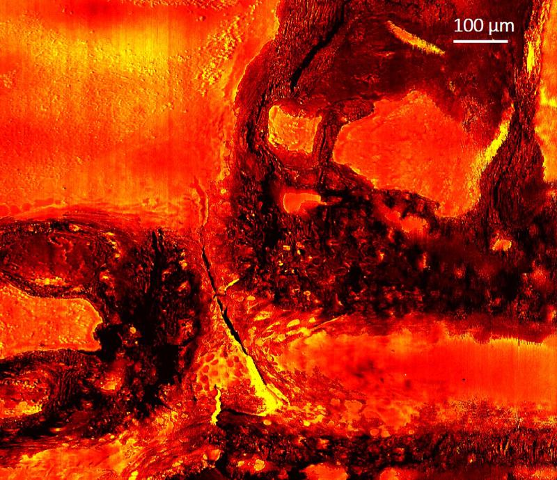 Immagine della sezione della spina dorsale di un topo ottenuta col nuovo microscopio vibrazionale per studiare il processo di calcificazione ossea Immagine della sezione della spina dorsale di un topo ottenuta col nuovo microscopio vibrazionale per studiare il processo di calcificazione ossea
