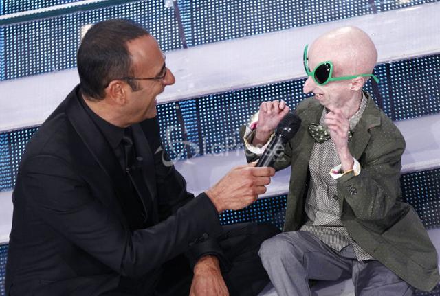 Un piccolo, ma grandissimo, eroe: Sammy Basso, intervistato da Carlo Conti sul palco di Sanremo 2015