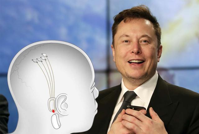 Elin Musk e Neuralink