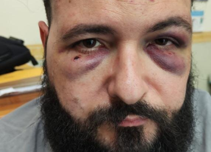 Napoli, picchiato per una spilla antifascista: arrestati tre di CasaPound