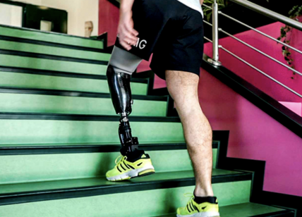 Nuova speranza per chi ha perso un arto: protesi che restituiscono il tatto